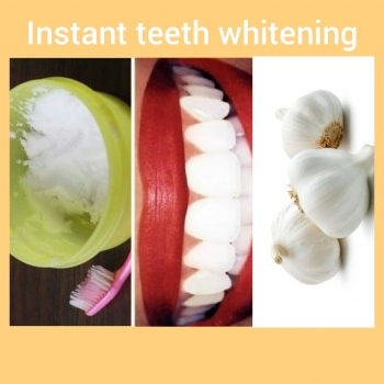 Instant Teeth Whitening In Two Minutes