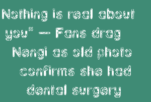 Nothing Is Real About You” – Fans Drag Nengi As Old Photo Confirms She Had Dental Surgery