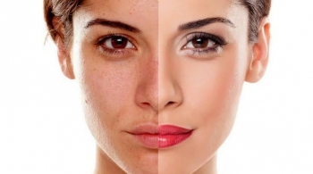 10 Ways To Take Good Care Of Dull-skin
