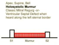 Heart Sounds 09 Apex, Supine, Bell Holosystolic Murmur, classic mitral regurgitation or Ventricular septal defect when heard along the left sternal border.mp3