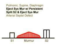 Heart Sounds 22 Pulmonic, Supine, Diaphragm, Ejection systolic murmur with persistent Split S2 & Ejection Systolic Murmur, Arterial Septal defect.mp3