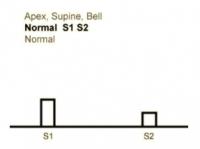 Heart Sounds 01 Apex, Supine, Bell Normal S1 and S2 sounds.mp3