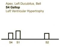 Heart sounds 03 Apex, Bell S4 Gallop, Left Lateral Decubitus, Left Ventricular Hypertrophy heart sounds.mp3